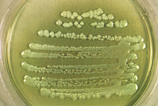 an image of the Pseudomonas Aeruginosa bacteria in a lab